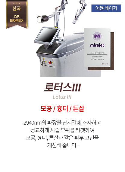 로터스3
