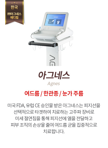 아그네스