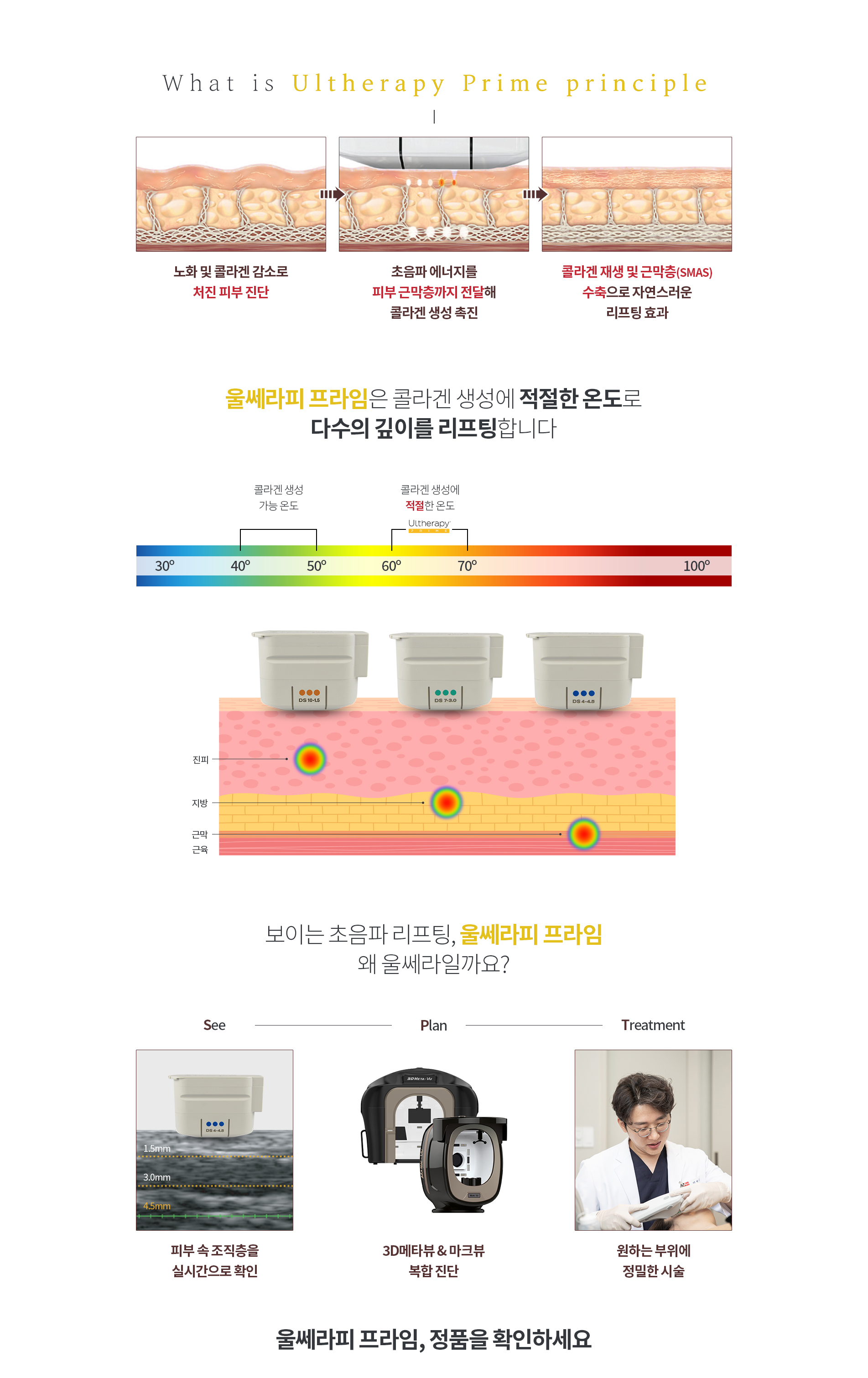 울쎄라피 프라임 02