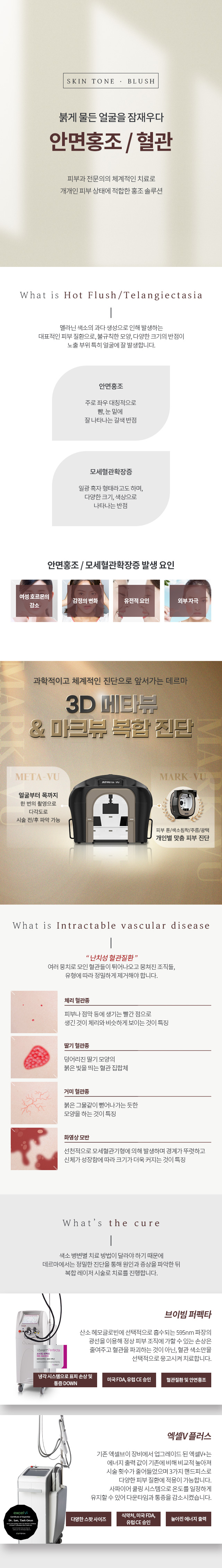 안면홍조/혈관
